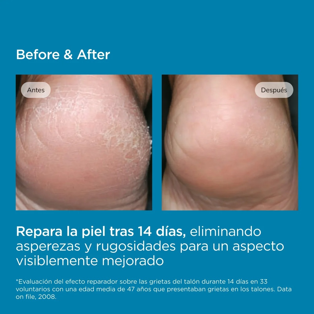 ISDIN – Ureadin Podos Gel-Huile Hydratant Pieds – 75ml 1