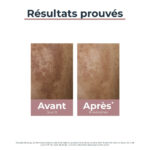 EUCERIN – Anti-Pigment Sérum Duo – 30ml 3