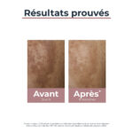 EUCERIN – Anti-Pigment Soin de Jour SPF30 – 50ml 2