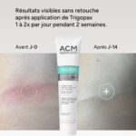ACM – Trigopax Soin Protecteur & Apaisant – 40ml 1